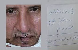 وضعیت اسفناک پیشکسوت پرسپولیس (عکس)