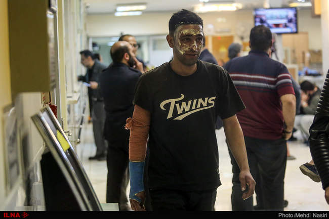 مصدومان مراسم چهارشنبه آخر سال 1396