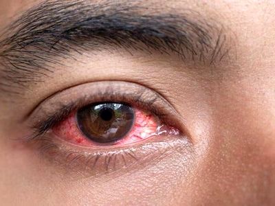 ۲۰ ثانیه استراحت برای چشم‌ها؛ بعد از هر ۲۰ دقیقه کار با دستگاه‌های دیجیتال ضروری است