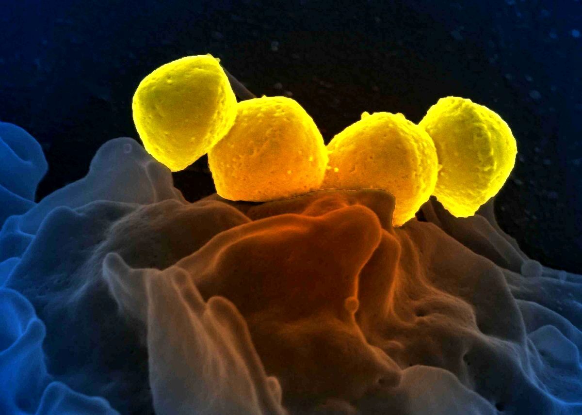 شیوع باکتری گوشتخوار در ژاپن؛ ۴۸ ساعته فرد مبتلا را می‌کُشد