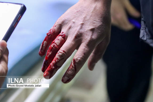 مصدومان آخرین چهارشنبه سال در بیمارستان شهید رجایی قزوین