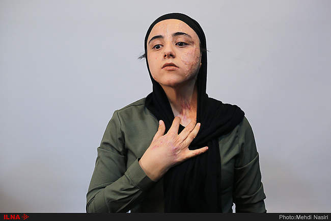 موج آرزوهای سوخته بر صورت دخترکان شین آبادی