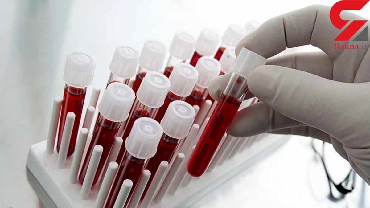پیش بینی مرگ با یک تست خون ساده