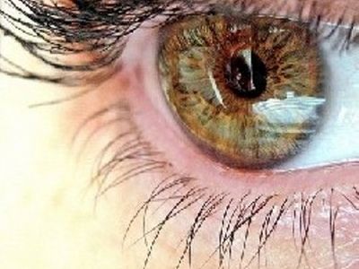 نزدیک بین بودن و دوربین بودن افراد هم ژنتیکی است؟