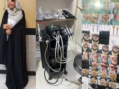 دستگیری دندانپزشک زن قلابی در رشت