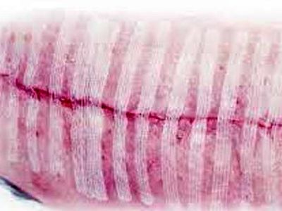 چسبی که جایگزین بخیه می شود+عکس 