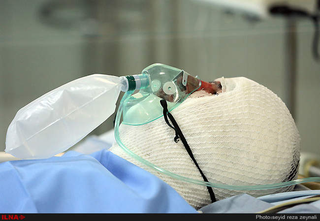 عیادت وزیر تعاون، کار و رفاه اجتماعی از مصدومین حادثه ذوب آهن اصفهان 